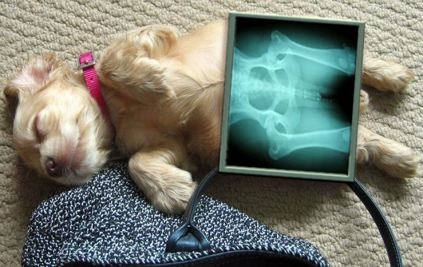 Рентгенография (одна проекция) Рентгенография (одна проекция)